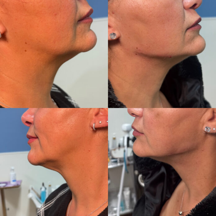 The Precision Foundation of Eternia Medspa The Precision Foundation of Eternia Medspa